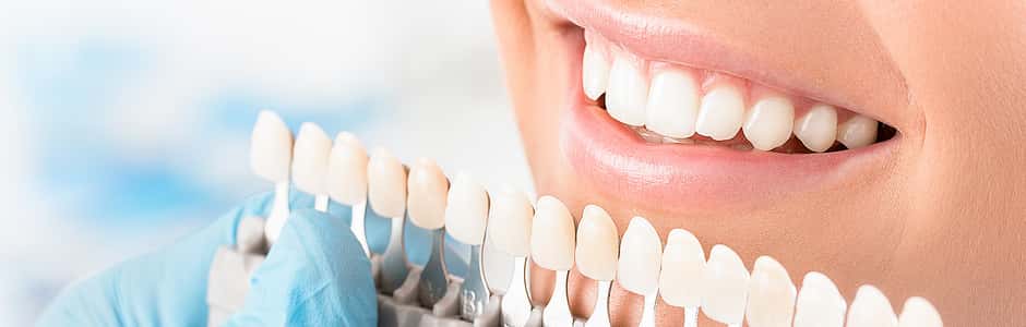 Weiße Zähne: Frau hat durch Zahnbleaching weiße Zähne