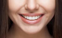Weiße Zähne: Eine Frau zeigt ihr Lächeln