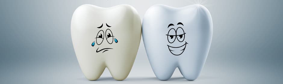 Richtige Zahnpasta: ein gelblicher Zahn und ein weißer Zahn nebeneinander verdeutlichen, warum Fluorid in Zahnpasta wichtig ist.